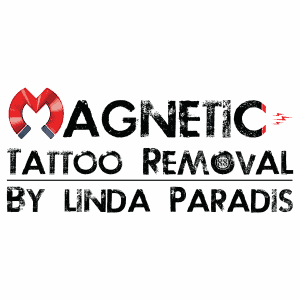 16580722 magnetic tattoo removal by lind 300x300 1